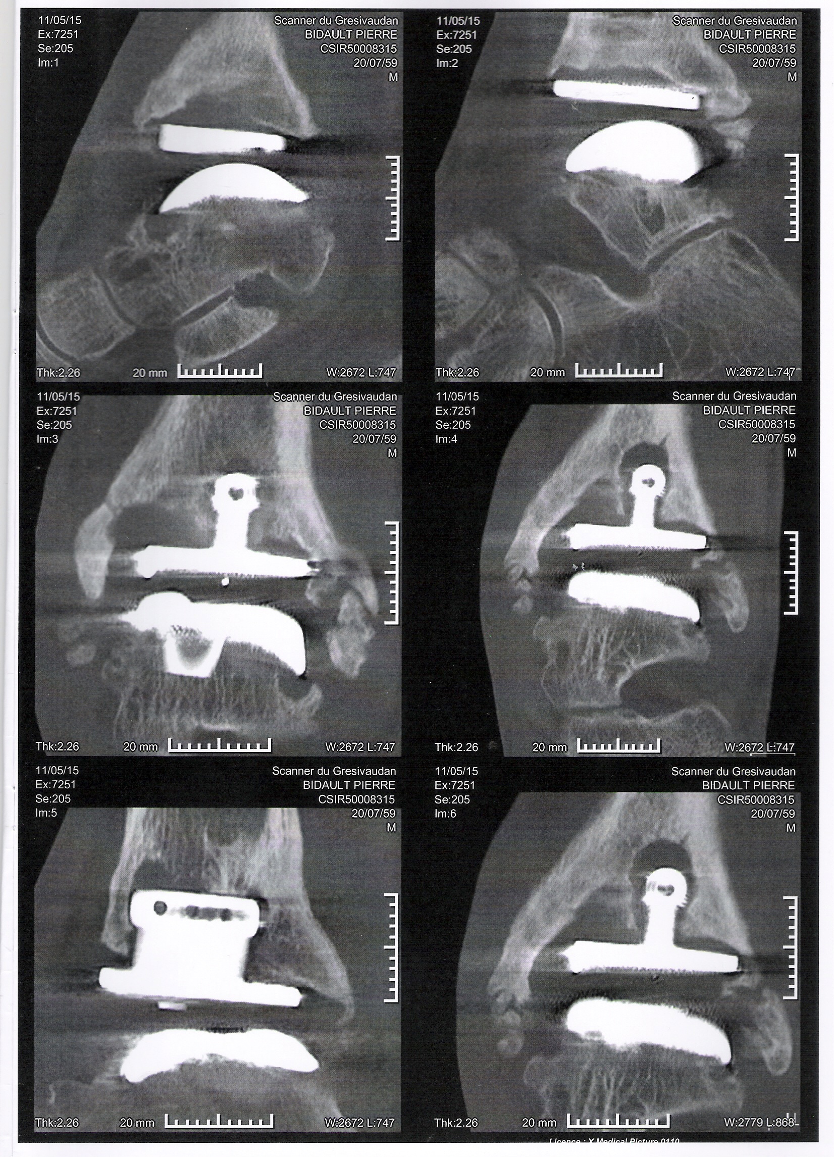 Clichés scanner du 11 mai 2015.jpg